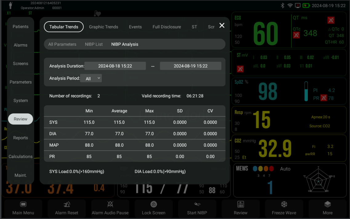 pefor datafanyifanyiST and QT analysis NIBP analysis