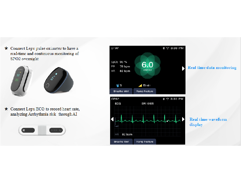 nyi利点 Bluetooth制約軽減 心電図血液酸素