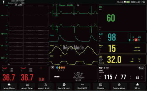 ypefor datafanyifanyiMini Trend View ECG Ha